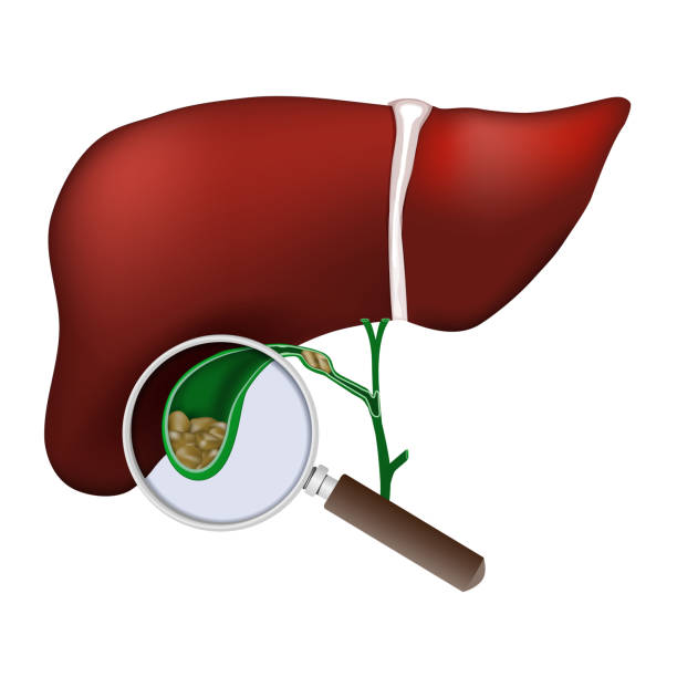 liver. Close-up of Gallbladder. magnifying glass examines gallstones vector art illustration
