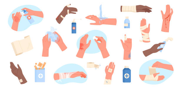 Injured hands set, human arms with wounds and burn, cleaning and dressing with bandages Injured hands set vector illustration. Cartoon isolated human arms with wounds and burn on body skin, cleaning and dressing with bandages, applying medical treatment for injury, first aid for trauma bandage arm stock illustrations