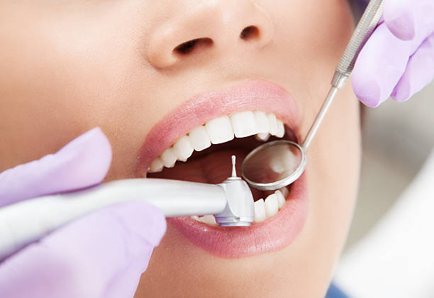 procedimiento médico - mouth open dental drill holding doctor fotografías e imágenes de stock
