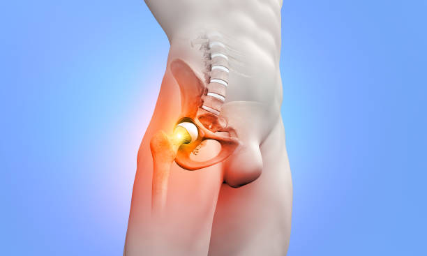 istock Femur bone pain medical illustration 1623722663