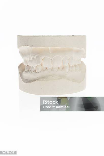 Ortodontyczny Gipsowy Modello - Fotografie stock e altre immagini di Acciaio - Acciaio, Anatomia umana, Apparecchio ortodontico