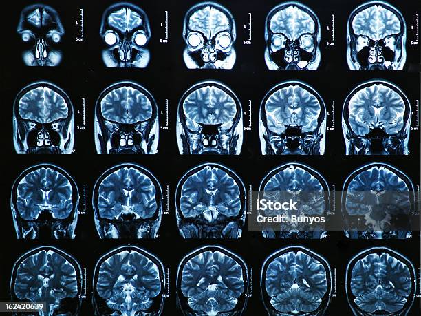 Photo libre de droit de Cerveau Scanner À Résonance Magnétique banque d'images et plus d'images libres de droit de Imagerie par rayons x - Imagerie par rayons x, Masque de beauté, Anatomie