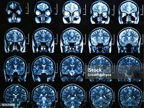 Mri는 뇌 스캔 엑스레이 이미지에 대한 스톡 사진 및 기타 이미지 - 엑스레이 이미지, 페이셜 마스크, CAT 스캔 기계