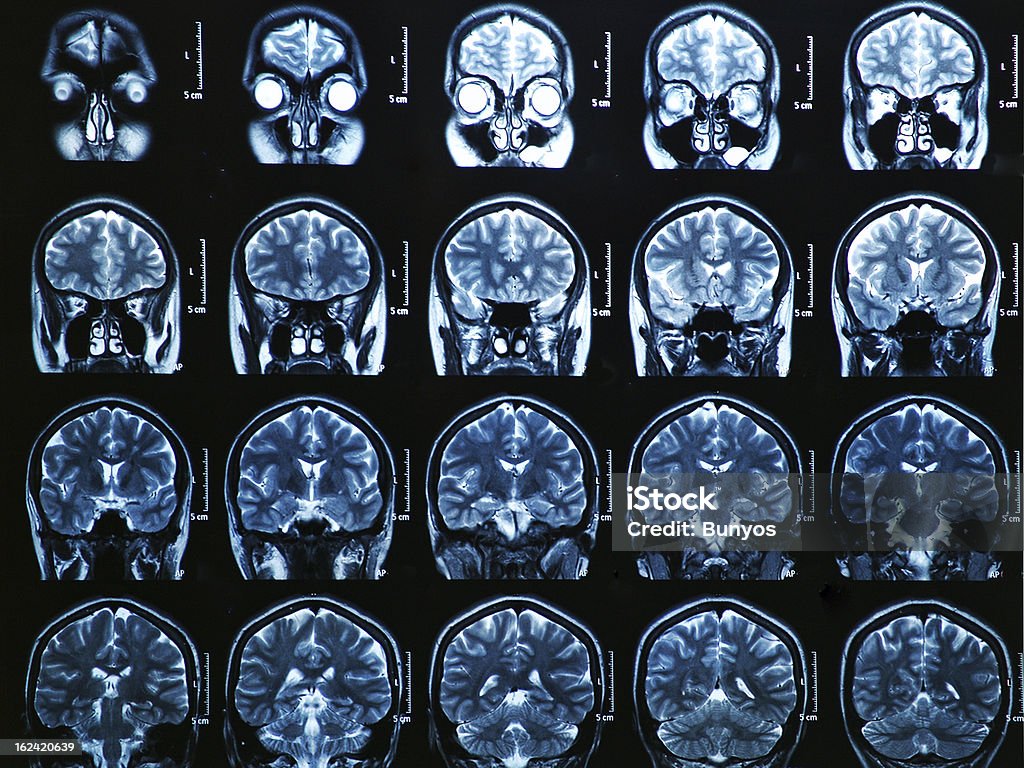 МРТ-сканирование головного мозга - Стоковые фото Маска для лица роялти-фри