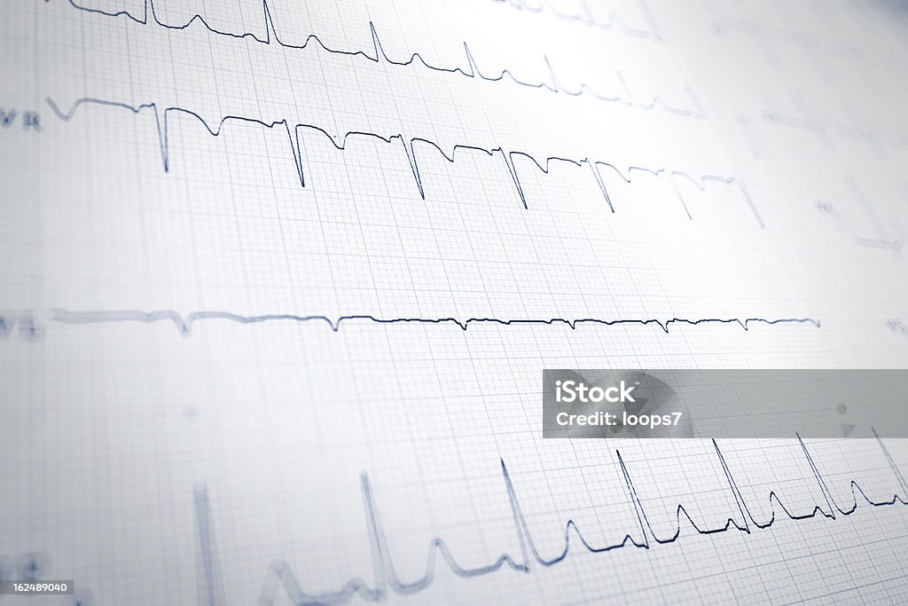 cardiogram - Photo de Électroencéphalogramme libre de droits