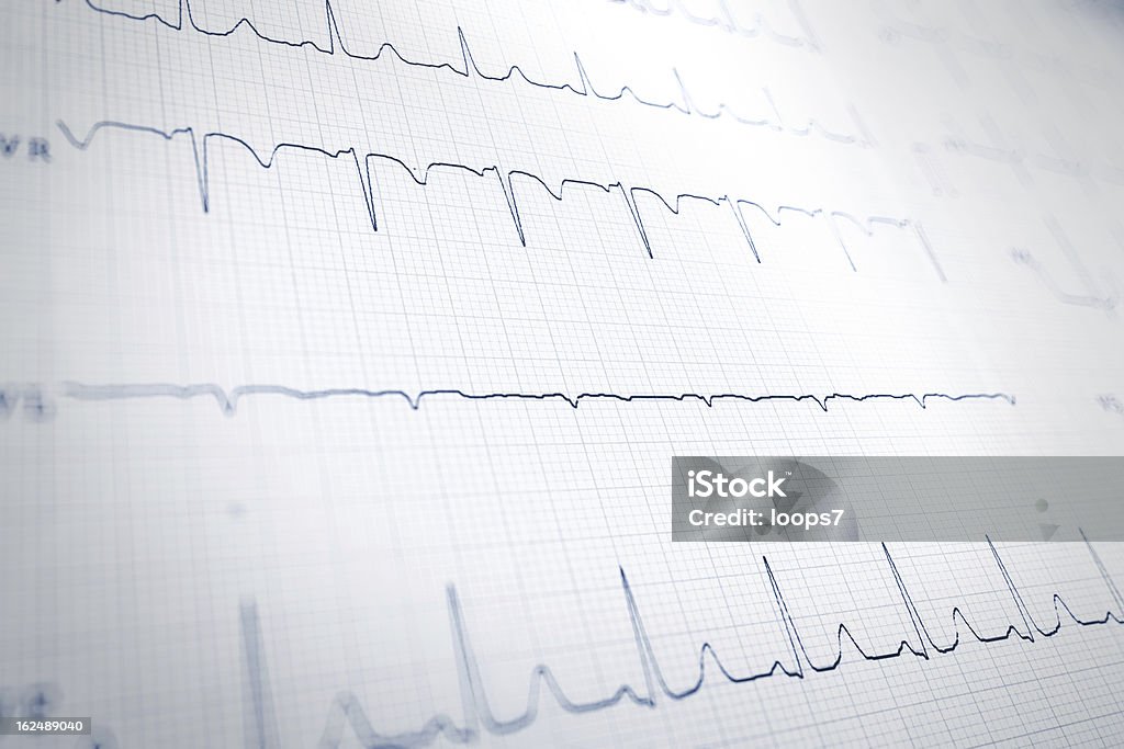 심전도 - 로열티 프리 뇌전도 스톡 사진