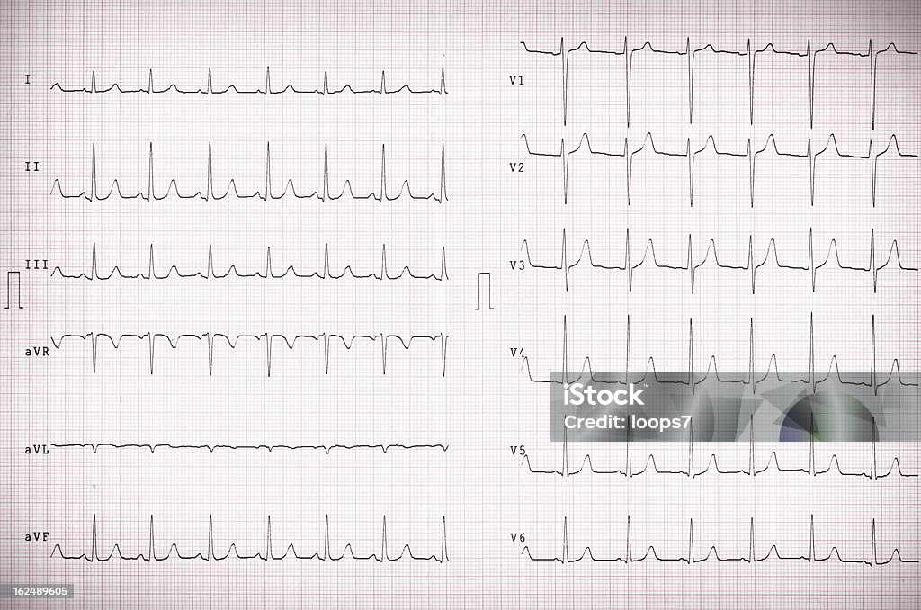 cardiogram - Lizenzfrei Bildhintergrund Stock-Foto