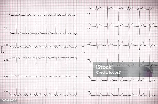 Cardiogram - オシロスコープのストックフォトや画像を多数ご用意 - オシロスコープ, テクノロジー, ヒトの内臓
