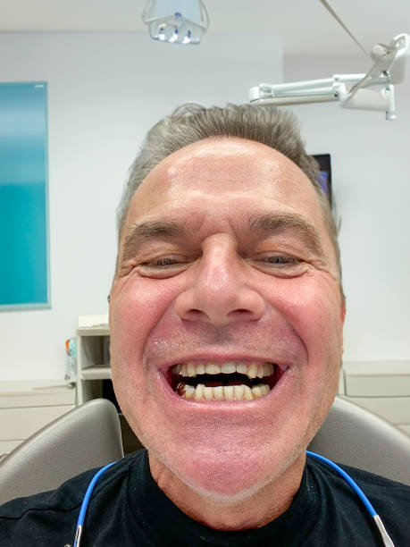 istock Man showing his old teeth before getting new teeth at the dentist 1625144735