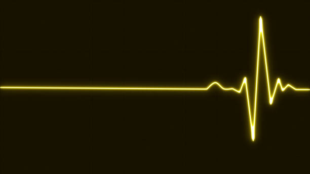 istock Bright neon yellow  Heartbeat pulse line rate graph. Electrocardiogram show heart beat line. cardiogram, Heart pulse. Medical laboratory concept 1625724022