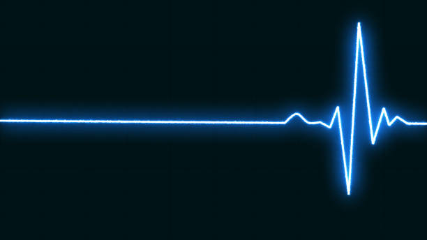 istock Emergency EKG monitoring. Blue glowing neon heart pulse long line. Heart beat. Electrocardiogram. cardiogram, cardiology Heart pulse. Medical laboratory concept 1625726182