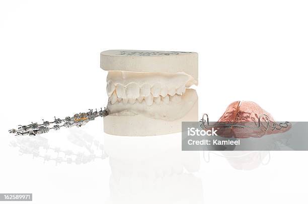Ortodontyczny Gipsowy Model And Elementu - zdjęcia stockowe i więcej obrazów Anatomia człowieka - Anatomia człowieka, Aparat ortodontyczny, Białe tło