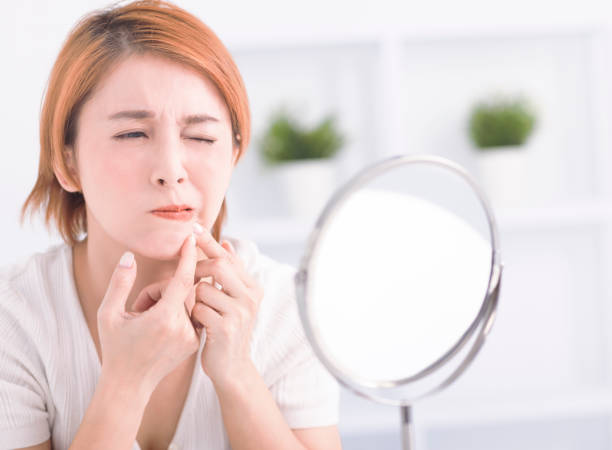 istock Young woman squeezing pimple spot for removing from face. 1626413437