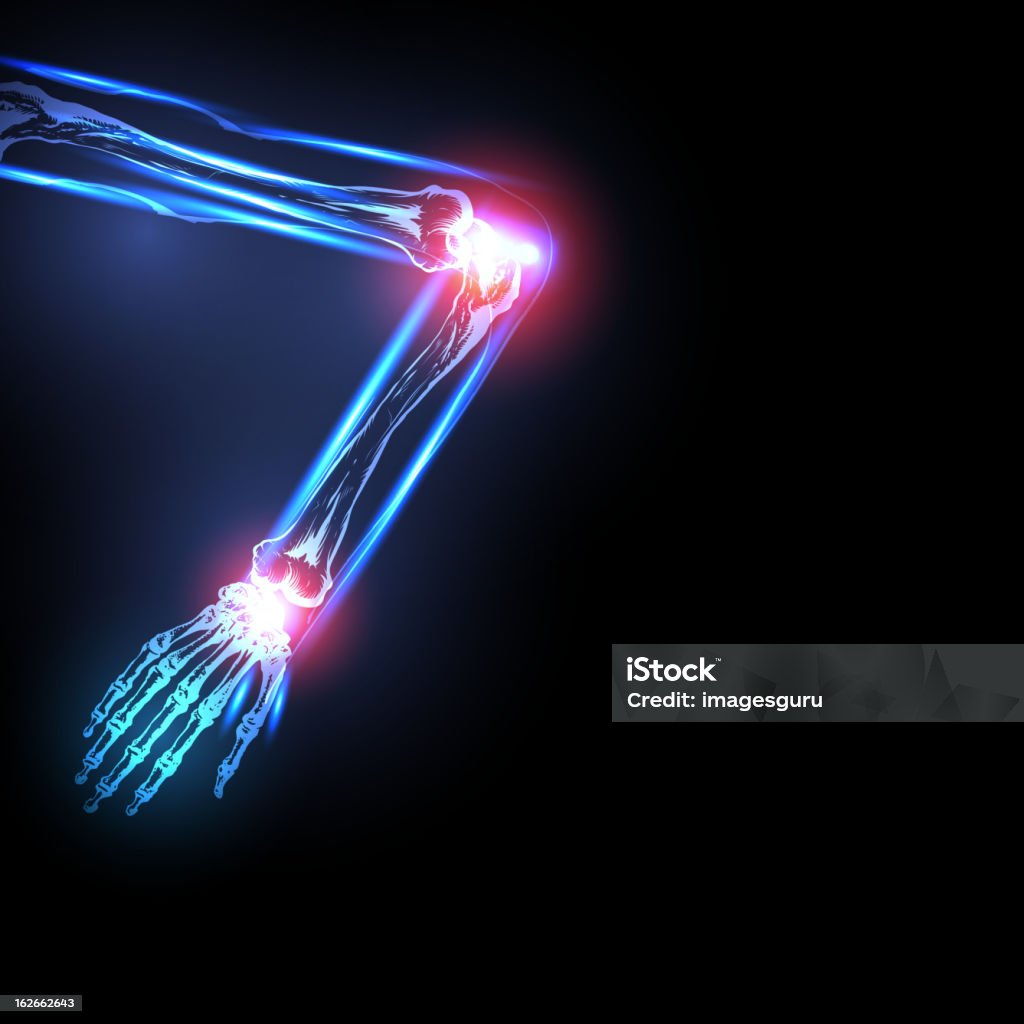 Schmerzen in Gelenke - Lizenzfrei Anatomie Vektorgrafik