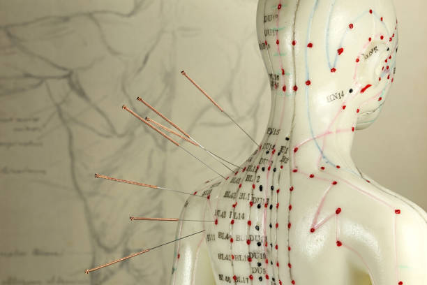 肩に針を持つ女性の鍼治療モデル - acupoints ストックフォトと画像