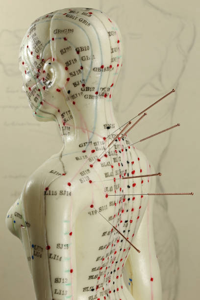 肩に針を持つ女性の鍼治療モデル - acupoints ストックフォトと画像