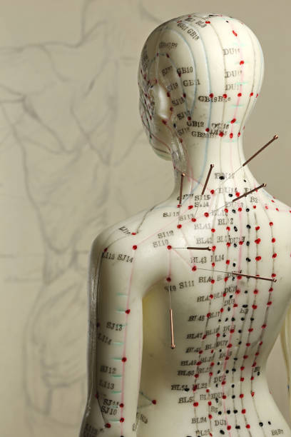 istock female acupuncture model with needles in the shoulder 1626911082
