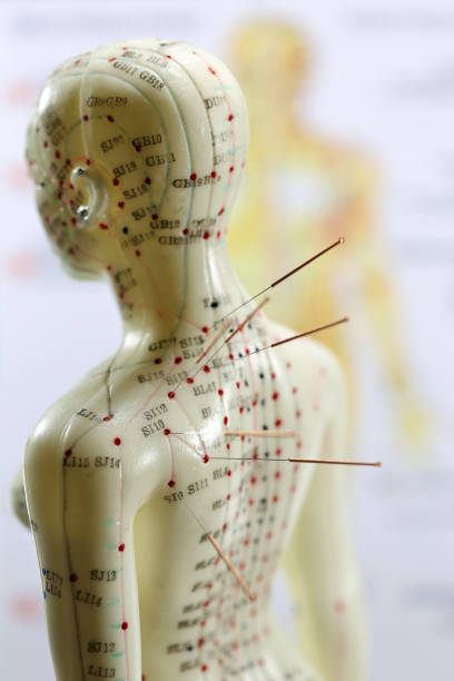 istock female acupuncture model with needles in the shoulder 1626911099