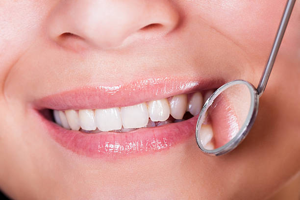 istock Smiling woman with perfect teeth 162713815