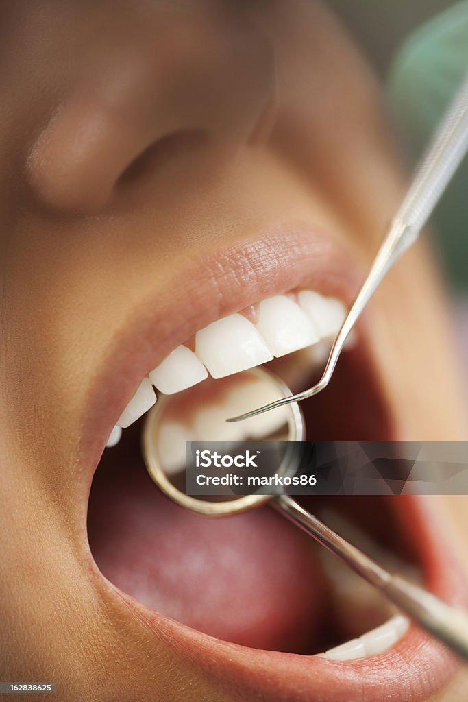Zbliżenie Dentysta badania - Zbiór zdjęć royalty-free (Badanie lekarskie)