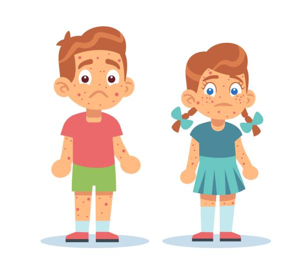 Boy and girl with skin problems, with rashes all over their bodies. Chickenpox, measles and atopic dermatitis. Dermatology treatment. Cartoon flat isolated illustration. Vector medical concept Boy and girl with skin problems, with rashes all over their bodies. Chickenpox, measles and atopic dermatitis. Dermatology treatment. Cartoon flat style isolated illustration. Vector medical concept measles illustrations stock illustrations