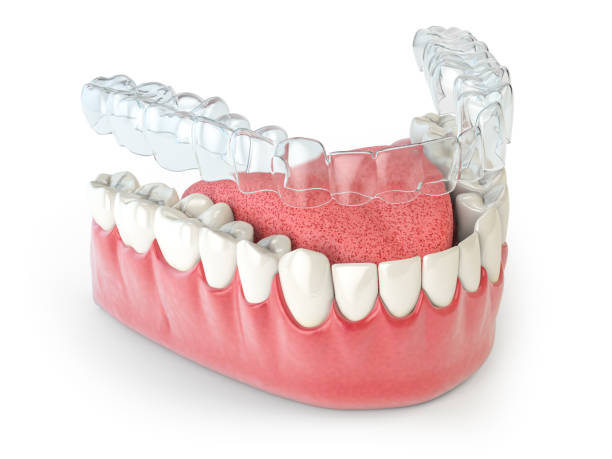 istock Invisalign invisible retainer  or braces with lawer jaw islated on white. 1630042731