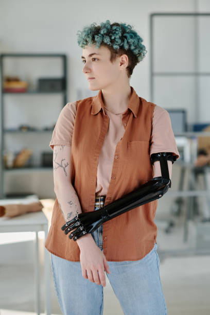 istock Young woman with bionic prosthetic arm posing in doctors office 1631438637