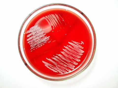 Growth of Staphylococcus. Sputum Culture in blood agar media.