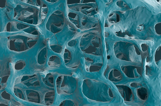 istock Fracture bones in osteoporosis - front view 3d illustration 1633112010