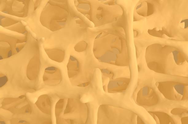 istock Fracture bones in osteoporosis - natural material front view 3d illustration 1633112012