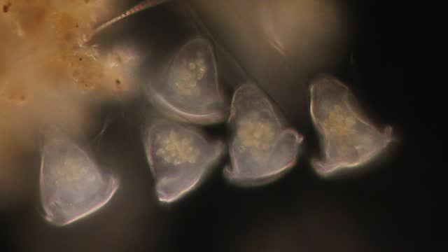 Protozoa and Algae under the microscope.