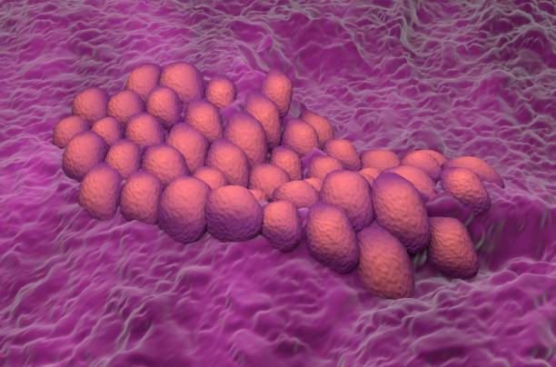 células cancerosas do endométrio (adenocarcinoma) no útero ou colo do útero (colo do útero) - ilustração 3d de visão isométrica - endometrial adenocarcinoma - fotografias e filmes do acervo