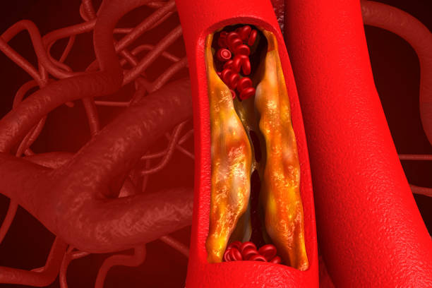 Clogged arteries on scientific background Clogged arteries on scientific background. 3d illustration endothelial stock pictures, royalty-free photos & images