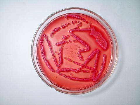 Growth of E coli. Urethral smear culture in macconkey  agar media.