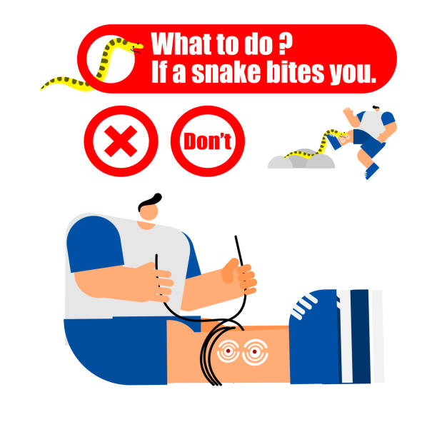 Biting First Aid Snake Bite First Aid Poster