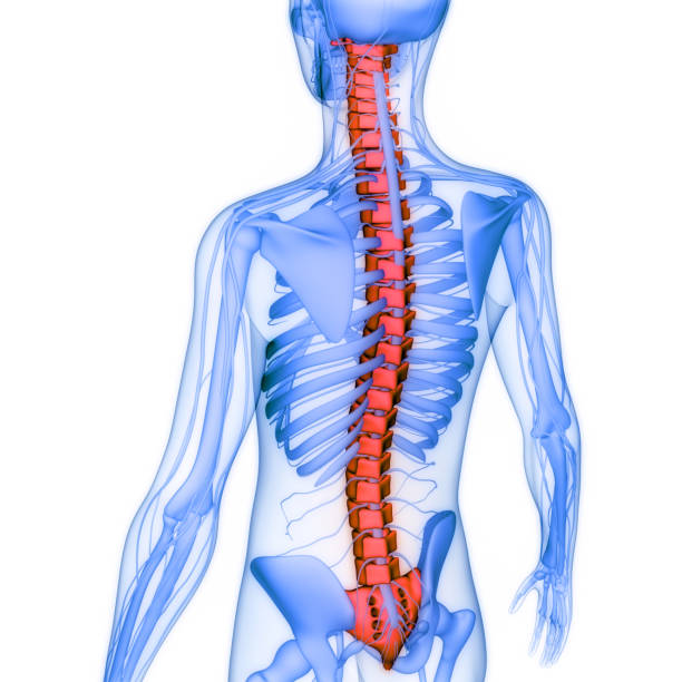 Lumbar intervertebral spine hernia. Spinal Fracture and traumatic vertebral injury. 3d illustration