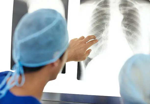 Closeup of a doctor's hand pointing to a patient's chest and lung x-ray