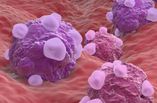 istock Ovarian cancer cell variations - closeup view 3d illustration 1637354462