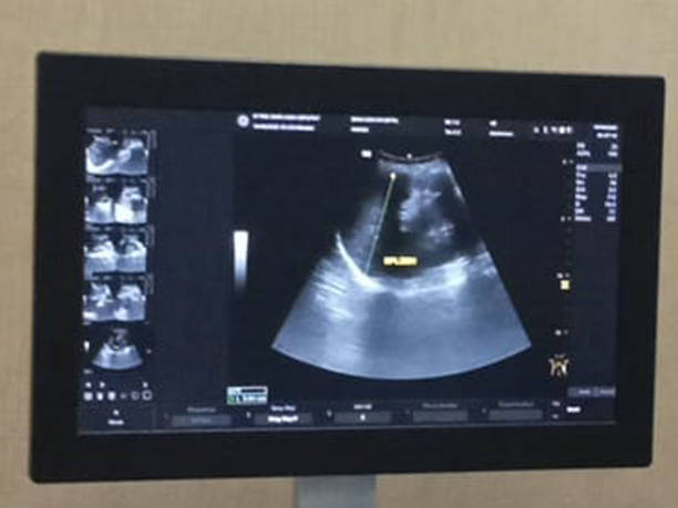 istock Miracle Unveiled: Capturing Life's Beginnings Through Ultrasound Imaging 1637410326