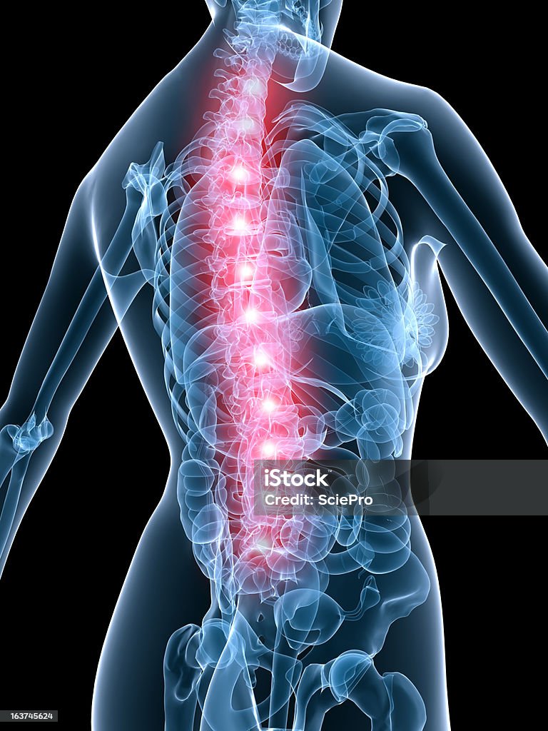 Rückenschmerzen Illustrationen - Lizenzfrei Anatomie Stock-Foto