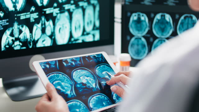 Doctor using Digital tablet  analyzing MRI scan