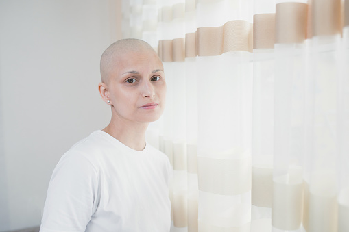 A young woman in a white t-shirt with oncology who has lost her hair after chemotherapy stands by the window, looks at the camera.