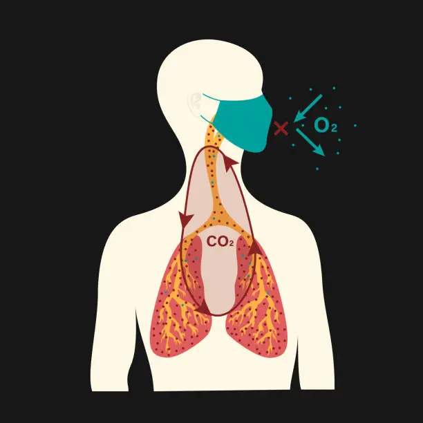 Vector illustration of The concept of health harm from wearing a medical mask for a long time.