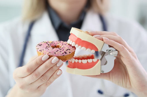 Woman imitates biting of sweet donut with human jaws model. Dentist in medical uniform explains impact of sweets on teeth health in clinic
