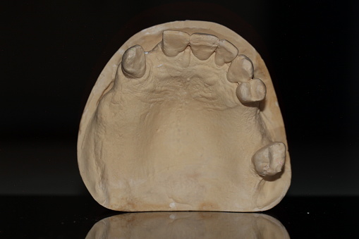 dental technician model removable prosthesis PAPM cobalt chrome resin wax tooth denture frame