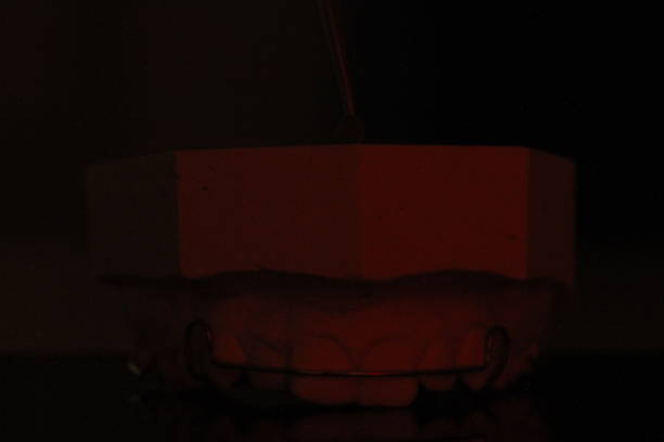 istock dental technician model orthosis resin wax tooth 1640285097