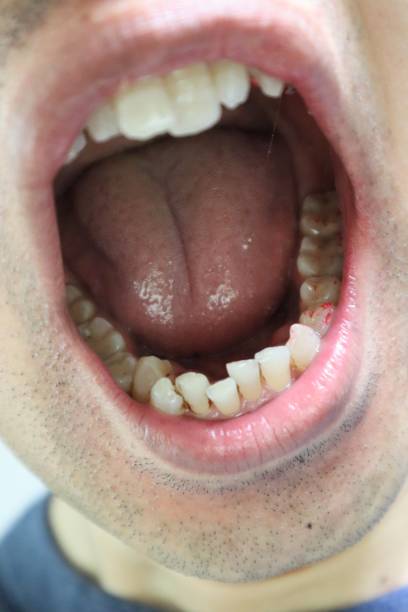 istock Japanese man immediately after treatment for tooth decay 1640795633