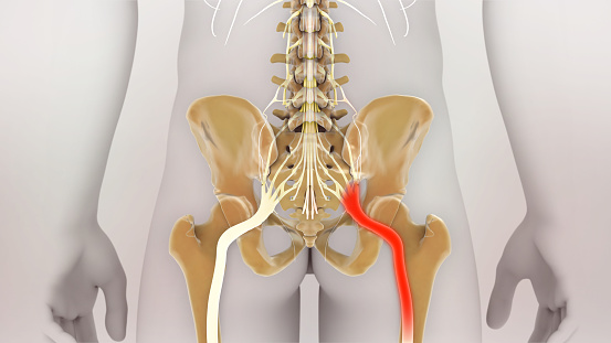 Sciatic Nerve Pain 3D Illustration