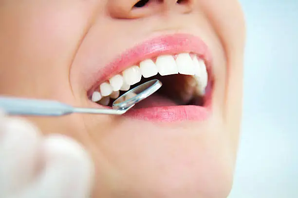 Photo of health female  teeths