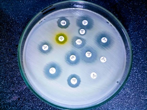 esbl negative in sensitivity test in muller hinton media. - esbl imagens e fotografias de stock